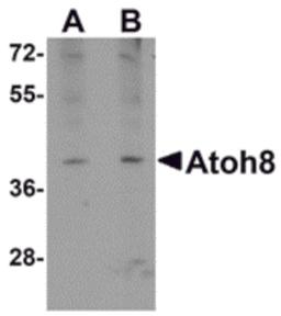 Western blot analysis of ATOH8 in A-20 cell lysate with ATOH8 antibody at (A) 1 and (B) 2 μg/mL.