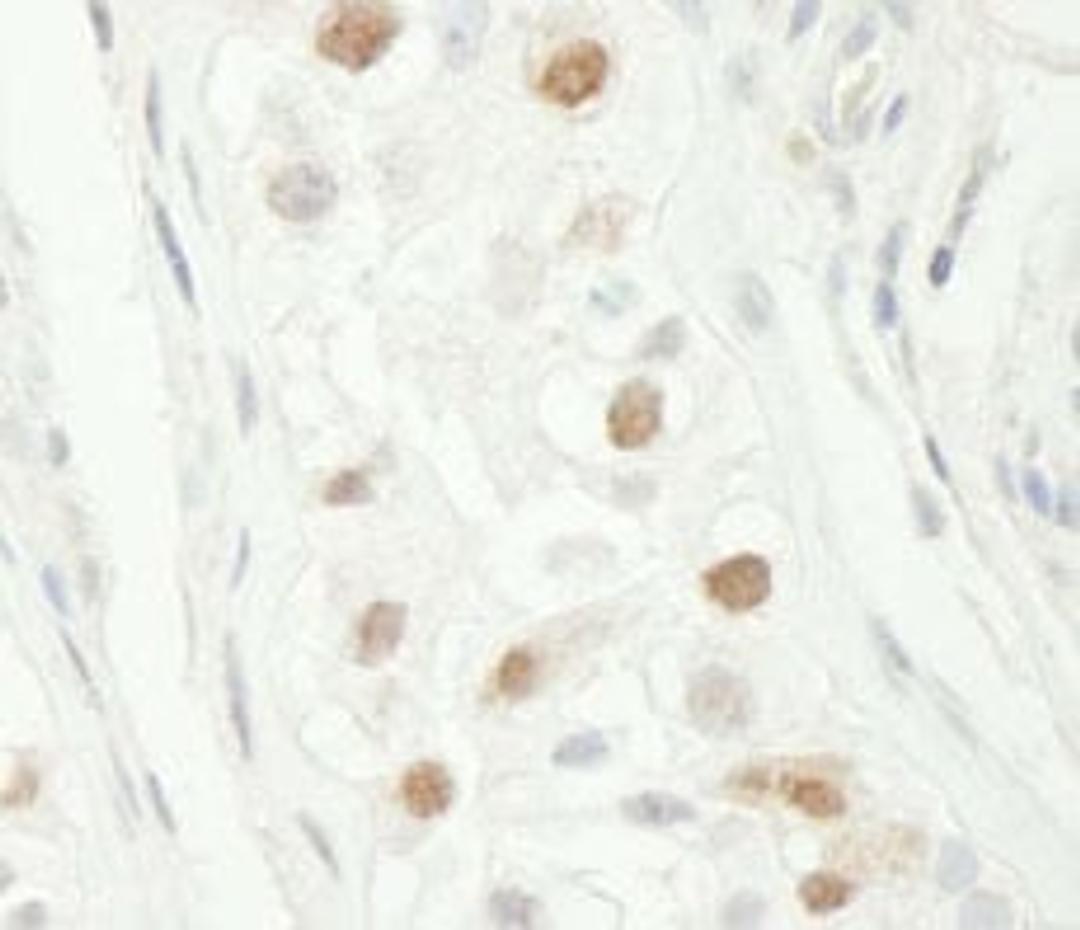 Detection of human Chk1 by immunohistochemistry.