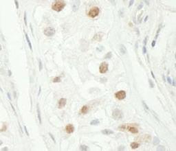 Detection of human Chk1 by immunohistochemistry.