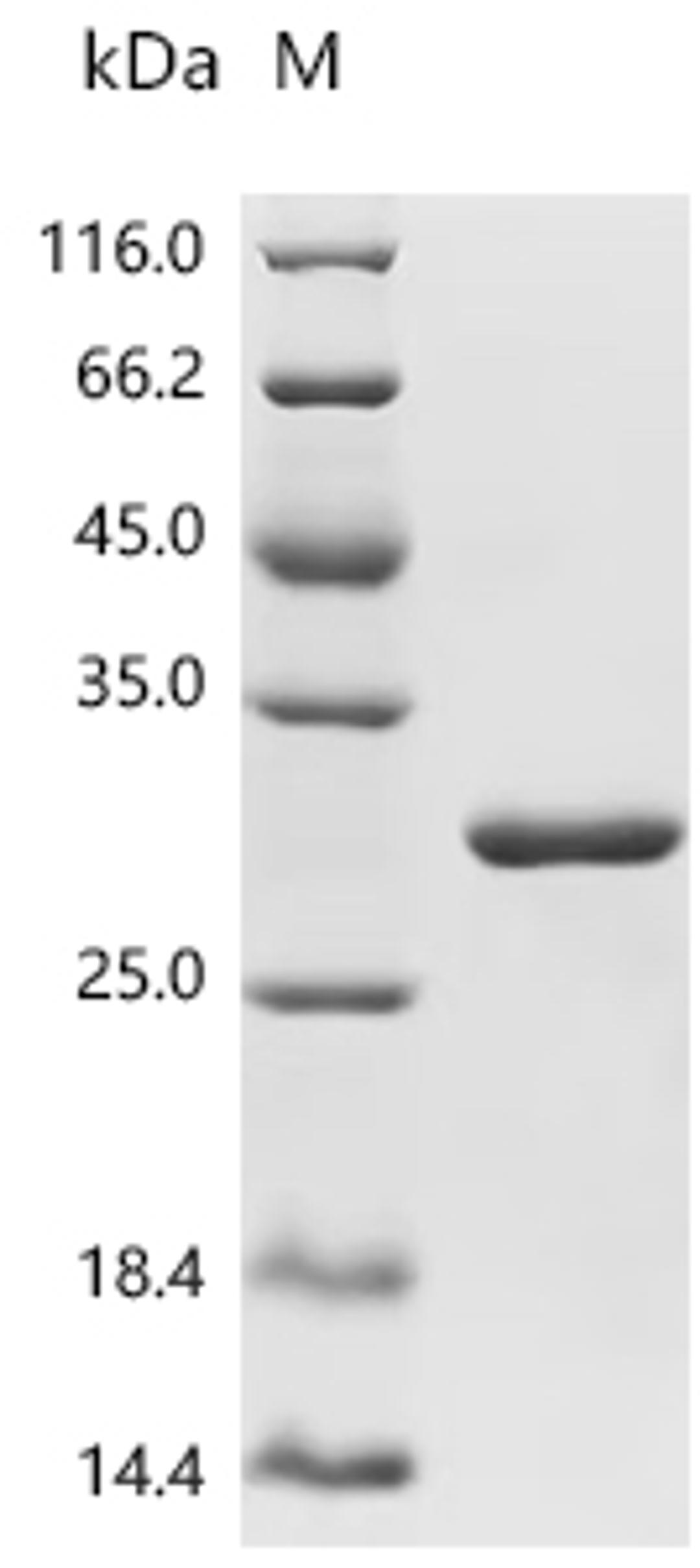 (Tris-Glycine gel) Discontinuous SDS-PAGE (reduced) with 5% enrichment gel and 15% separation gel.