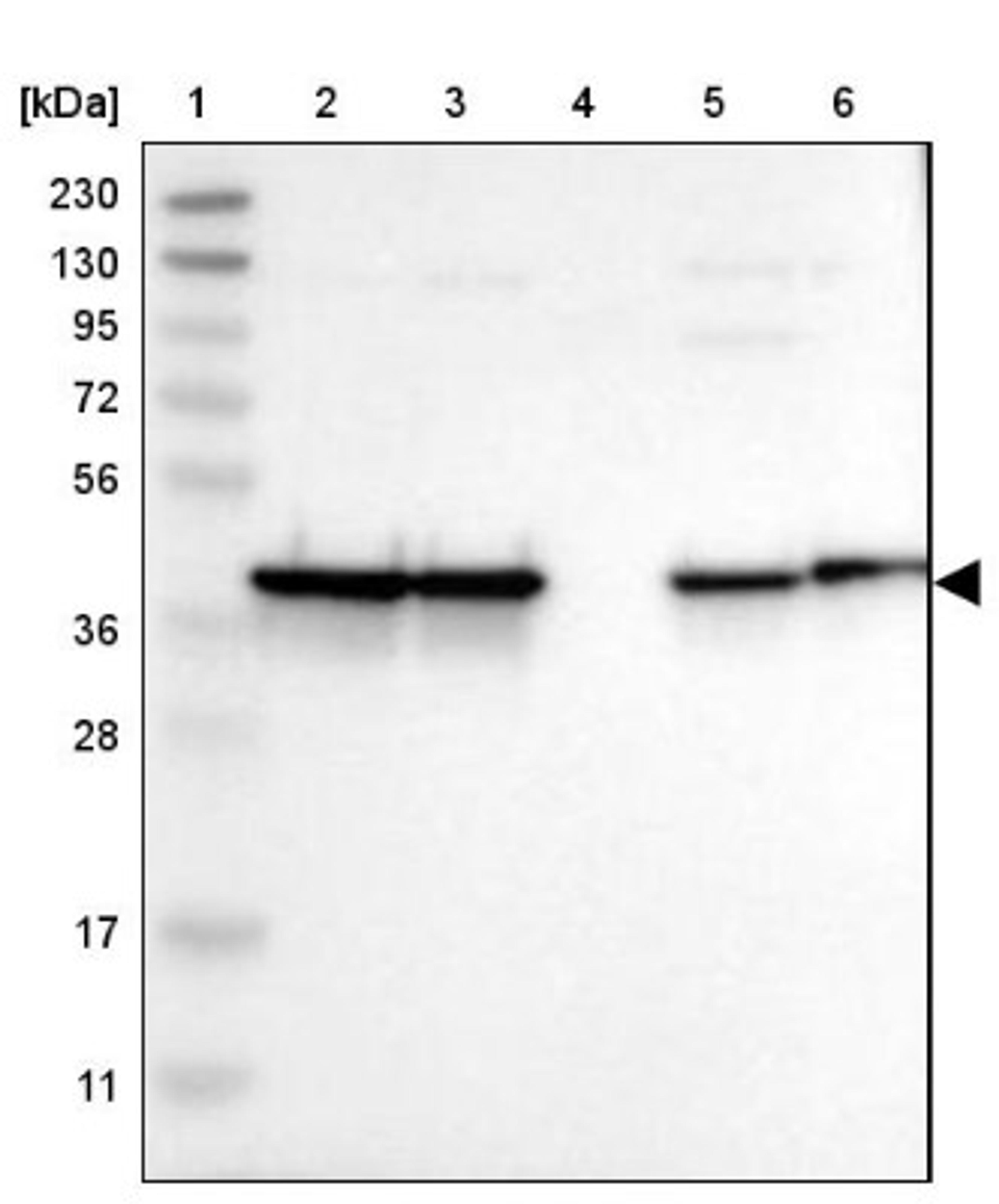 Western Blot: NANS Antibody [NBP1-87088] - Lane 1: Marker [kDa] 230, 130, 95, 72, 56, 36, 28, 17, 11<br/>Lane 2: Human cell line RT-4<br/>Lane 3: Human cell line U-251MG sp<br/>Lane 4: Human plasma (IgG/HSA depleted)<br/>Lane 5: Human liver tissue<br/>Lane 6: Human tonsil tissue