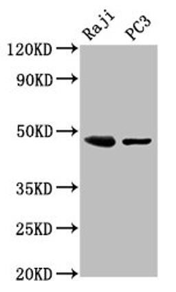 Western Blot. Positive WB detected in: Raji whole cell lysate, PC-3 whole cell lysate. All lanes: STRADB antibody at 3ug/ml. Secondary. Goat polyclonal to rabbit IgG at 1/50000 dilution. Predicted band size: 48, 43, 32 kDa. Observed band size: 48 kDa.