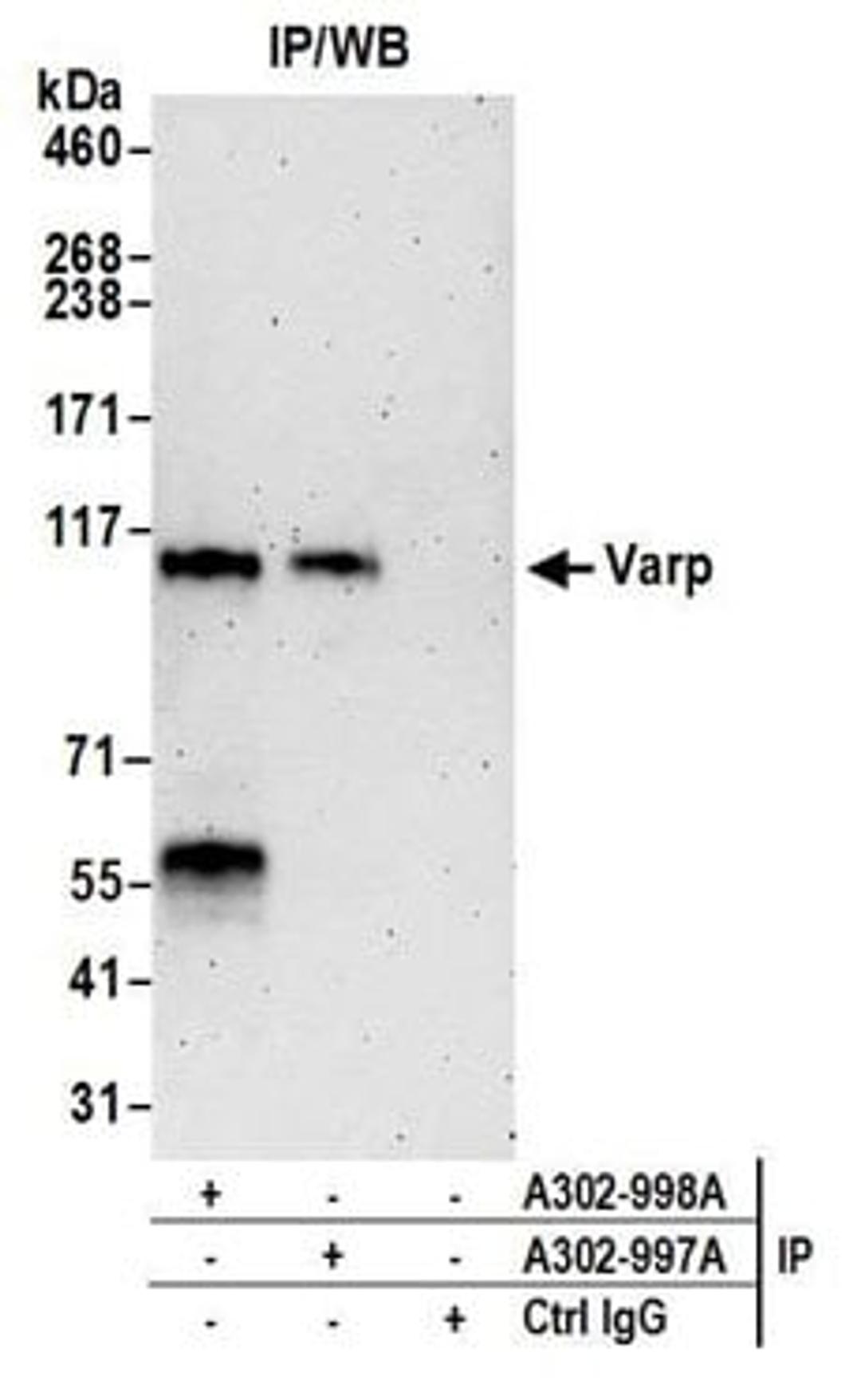 Detection of human Varp by western blot of immunoprecipitates.