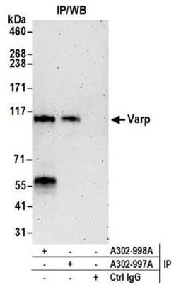 Detection of human Varp by western blot of immunoprecipitates.