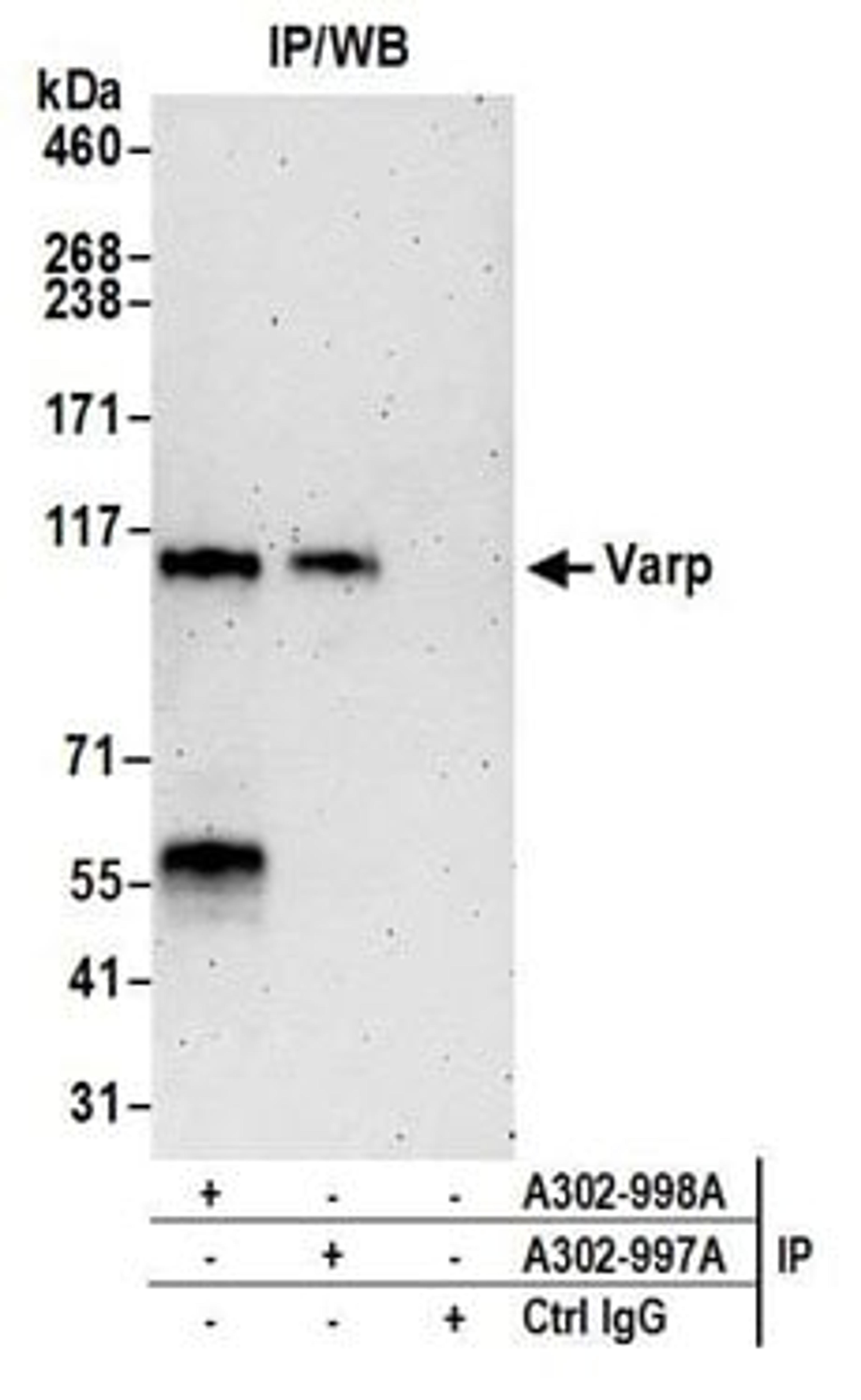 Detection of human Varp by western blot of immunoprecipitates.