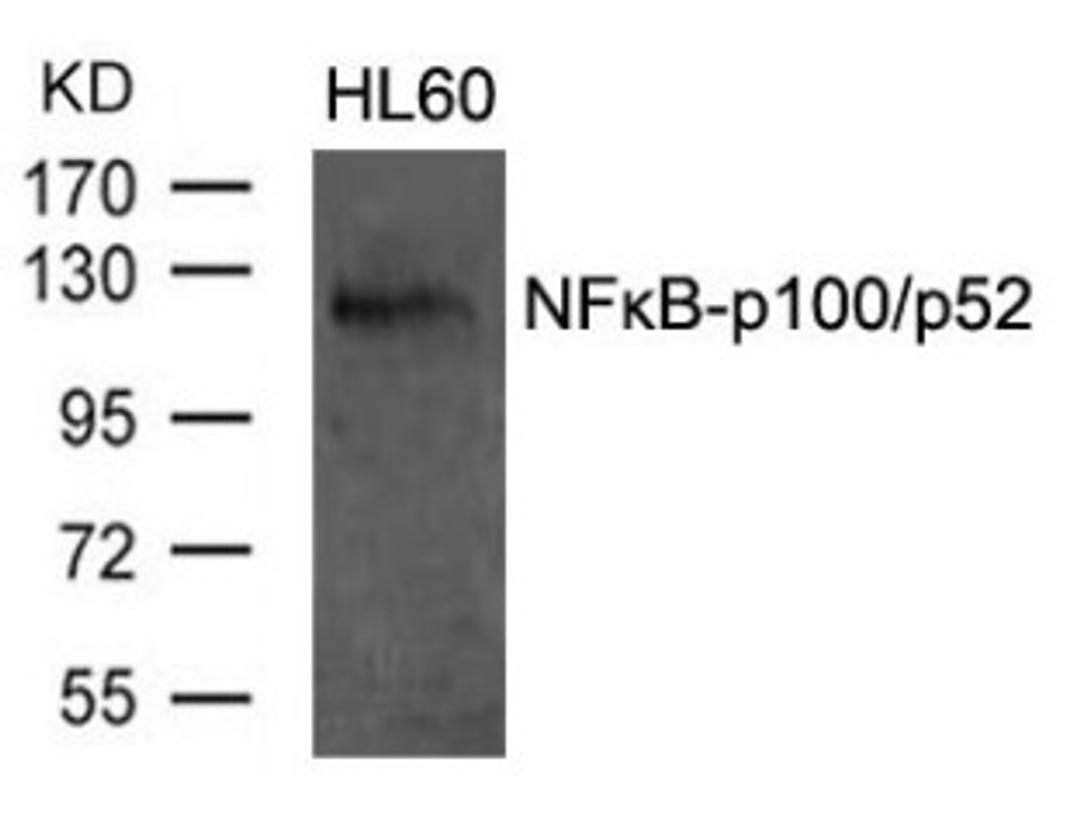 Western blot analysis of lysed extracts from HL60 cells using NFκB-p100/p52 (Ab-870).