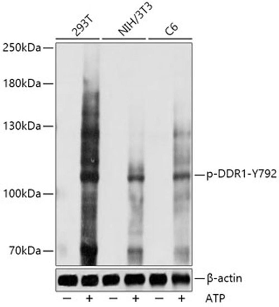 Western blot - Phospho-DDR1-Y792 antibody (AP1072)