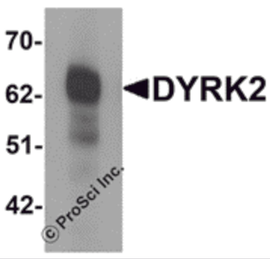 Western blot analysis of DYRK2 in 293 cell lysate with DYRK2 antibody at (A) 1 and (B) 2 &#956;g/mL.