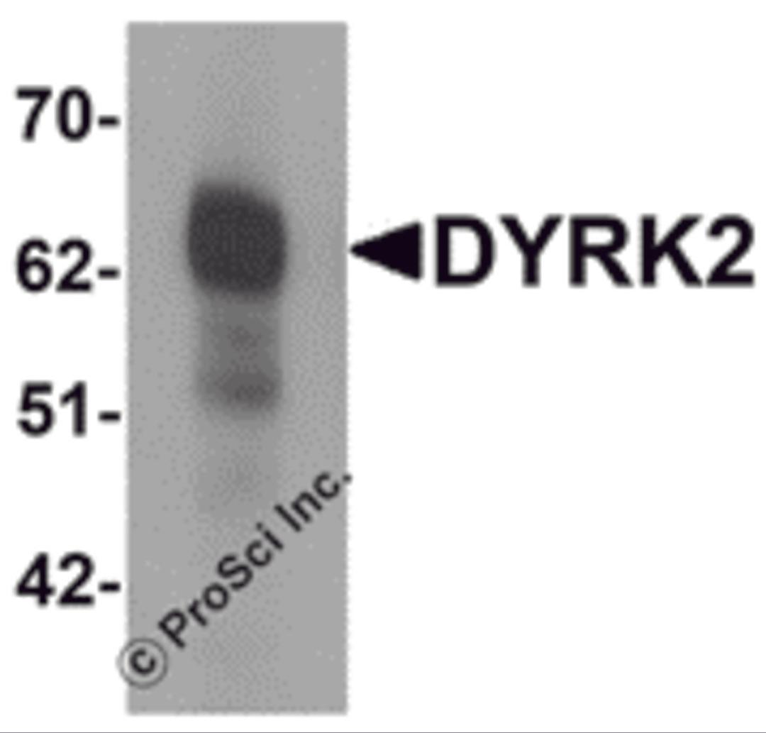 Western blot analysis of DYRK2 in 293 cell lysate with DYRK2 antibody at (A) 1 and (B) 2 μg/mL.