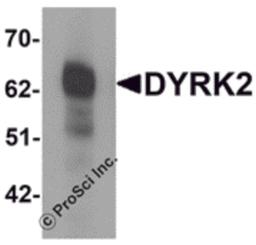 Western blot analysis of DYRK2 in 293 cell lysate with DYRK2 antibody at (A) 1 and (B) 2 μg/mL.