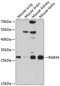 Western blot - RAB34 antibody (A10332)