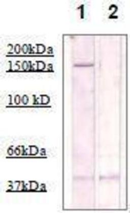 Western Blot: ROCK2 Antibody [NBP1-74493] - The cell lysate derived from Conditioned 3T3 cell was immunoprecipitated by Rabbit anti Rho Kinase (pT249), then immunoprobed by the same antibody at 1:500 (lane 1). Lane 2 is a negative control.