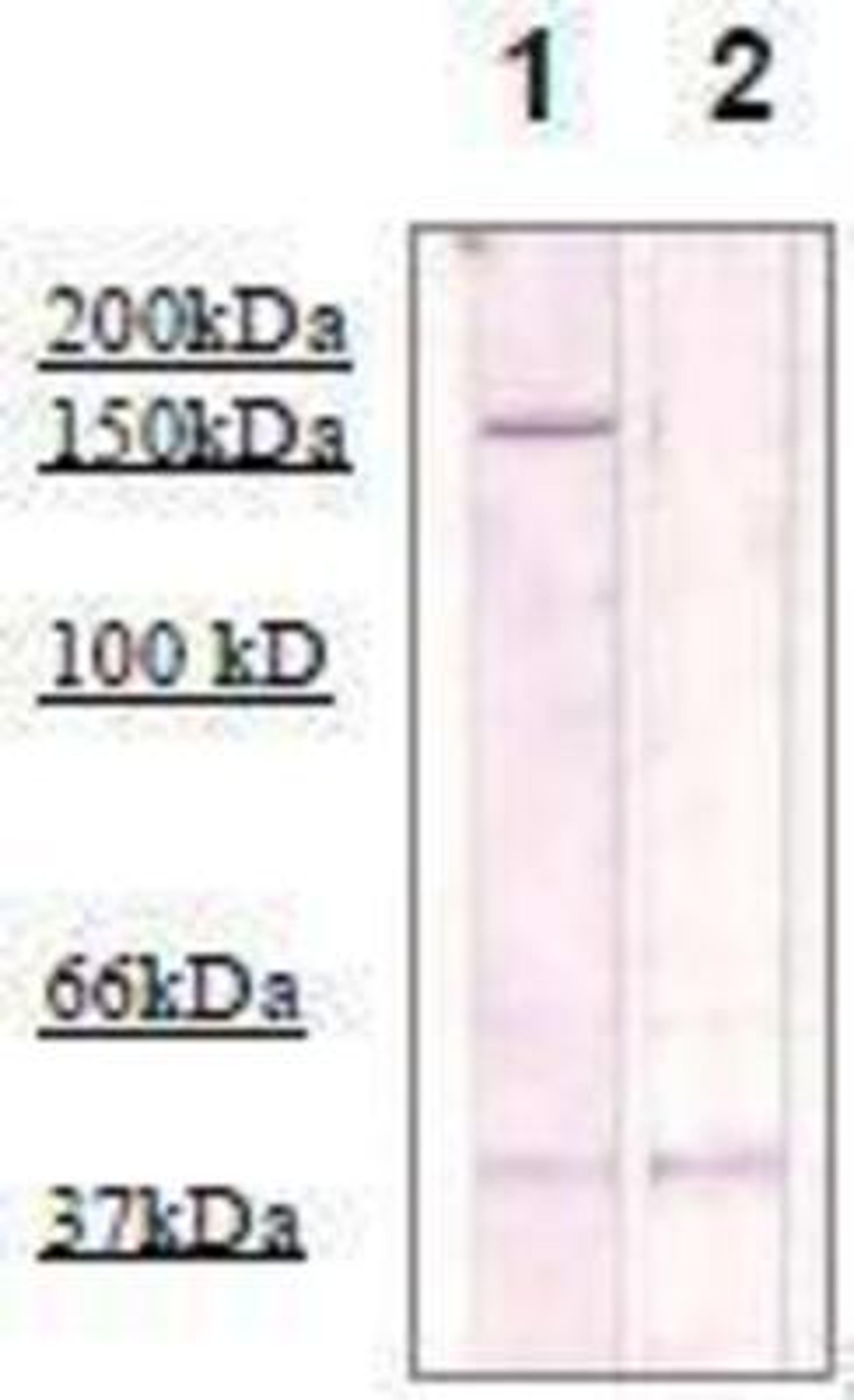 Western Blot: ROCK2 Antibody [NBP1-74493] - The cell lysate derived from Conditioned 3T3 cell was immunoprecipitated by Rabbit anti Rho Kinase (pT249), then immunoprobed by the same antibody at 1:500 (lane 1). Lane 2 is a negative control.