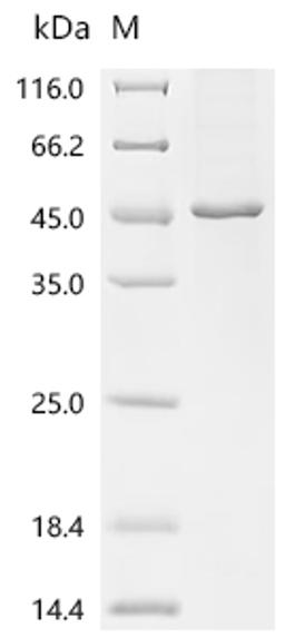 (Tris-Glycine gel) Discontinuous SDS-PAGE (reduced) with 5% enrichment gel and 15% separation gel.