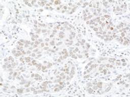 Detection of human WSTF by immunohistochemistry.