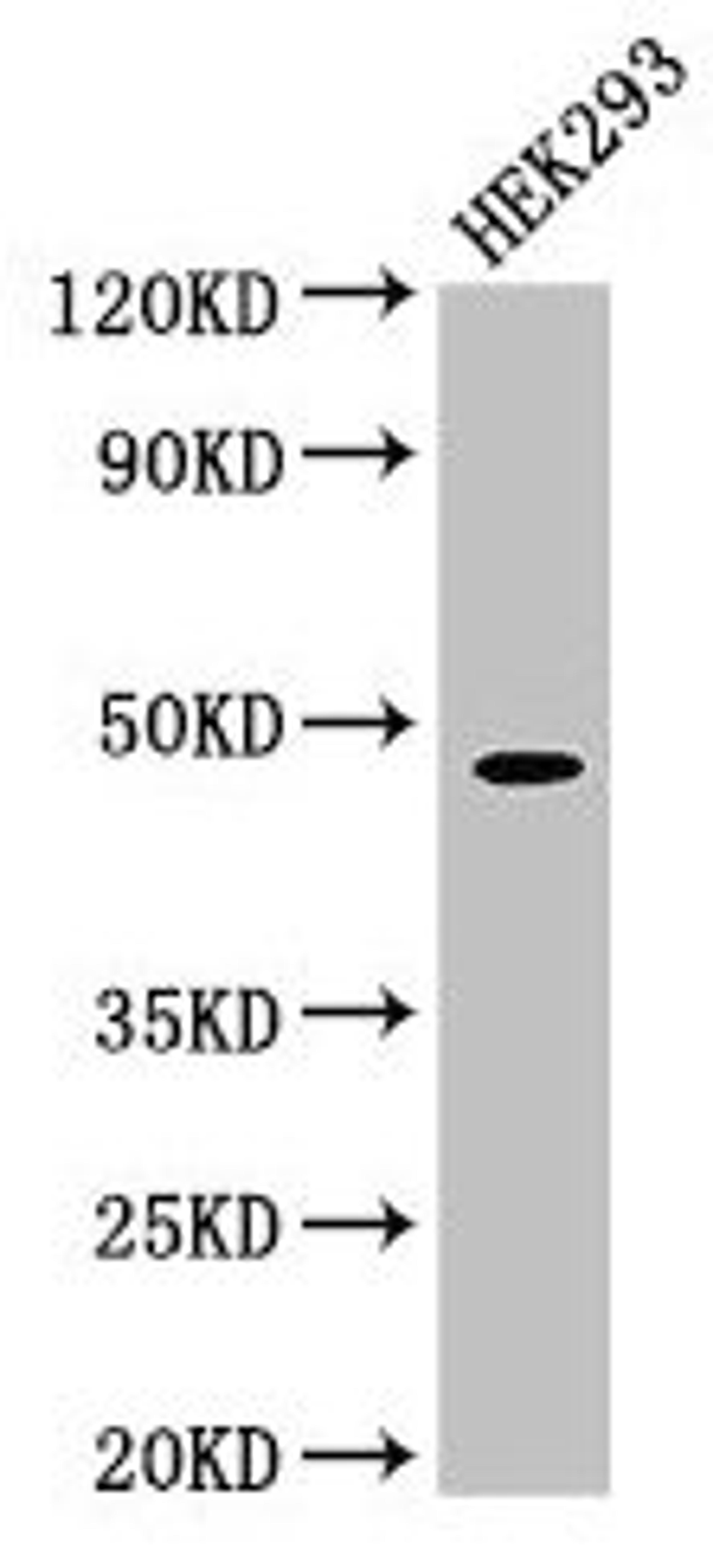 Western Blot. Positive WB detected in: HEK293 whole cell lysate. All lanes: PEPD antibody at 1.5µg/ml. Secondary. Goat polyclonal to rabbit IgG at 1/50000 dilution. Predicted band size: 55, 50, 48 kDa. Observed band size: 48 kDa