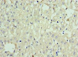 Immunohistochemistry of paraffin-embedded human liver tissue using CSB-PA858415ESR1HU at dilution of 1:100