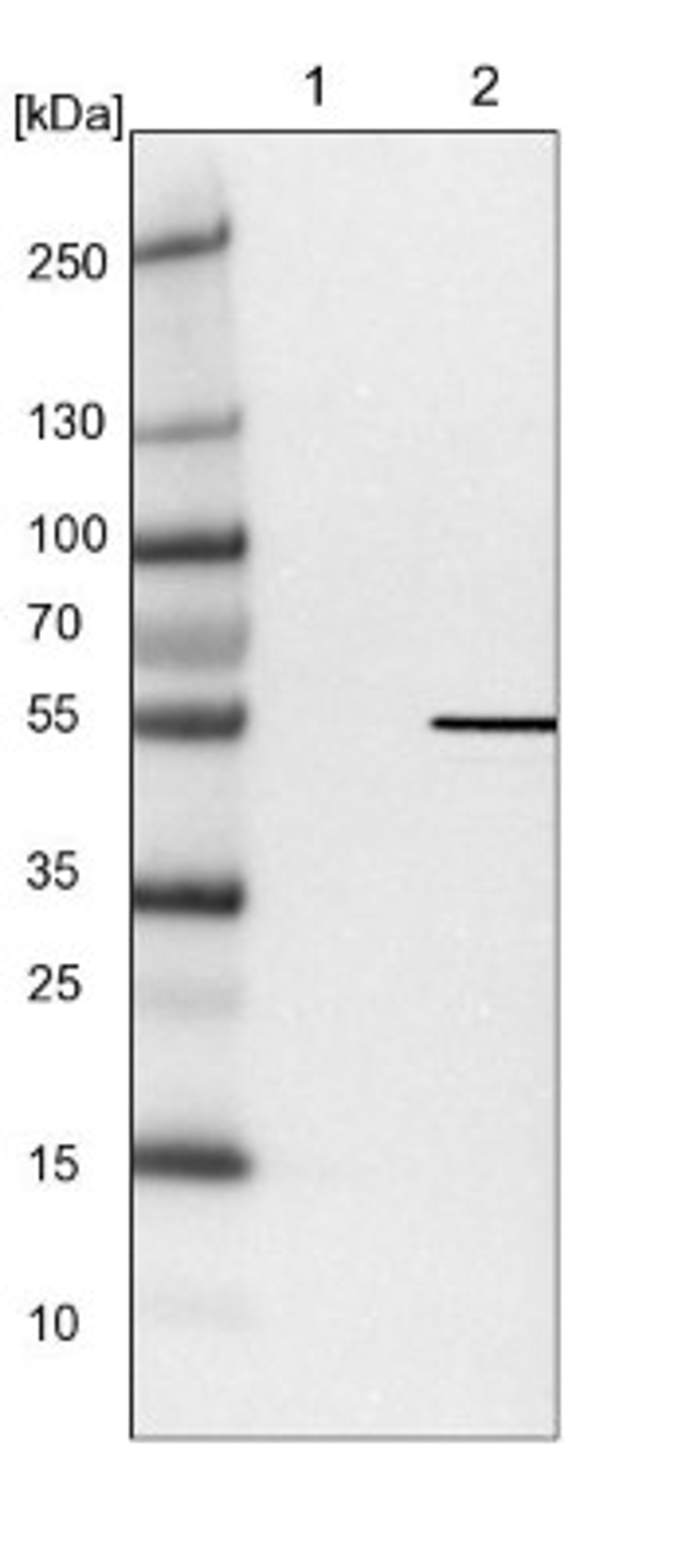 Western Blot: DNA Polymerase epsilon p59 Antibody [NBP1-87970] - Lane 1: NIH-3T3 cell lysate (Mouse embryonic fibroblast cells)<br/>Lane 2: NBT-II cell lysate (Rat Wistar bladder tumour cells)