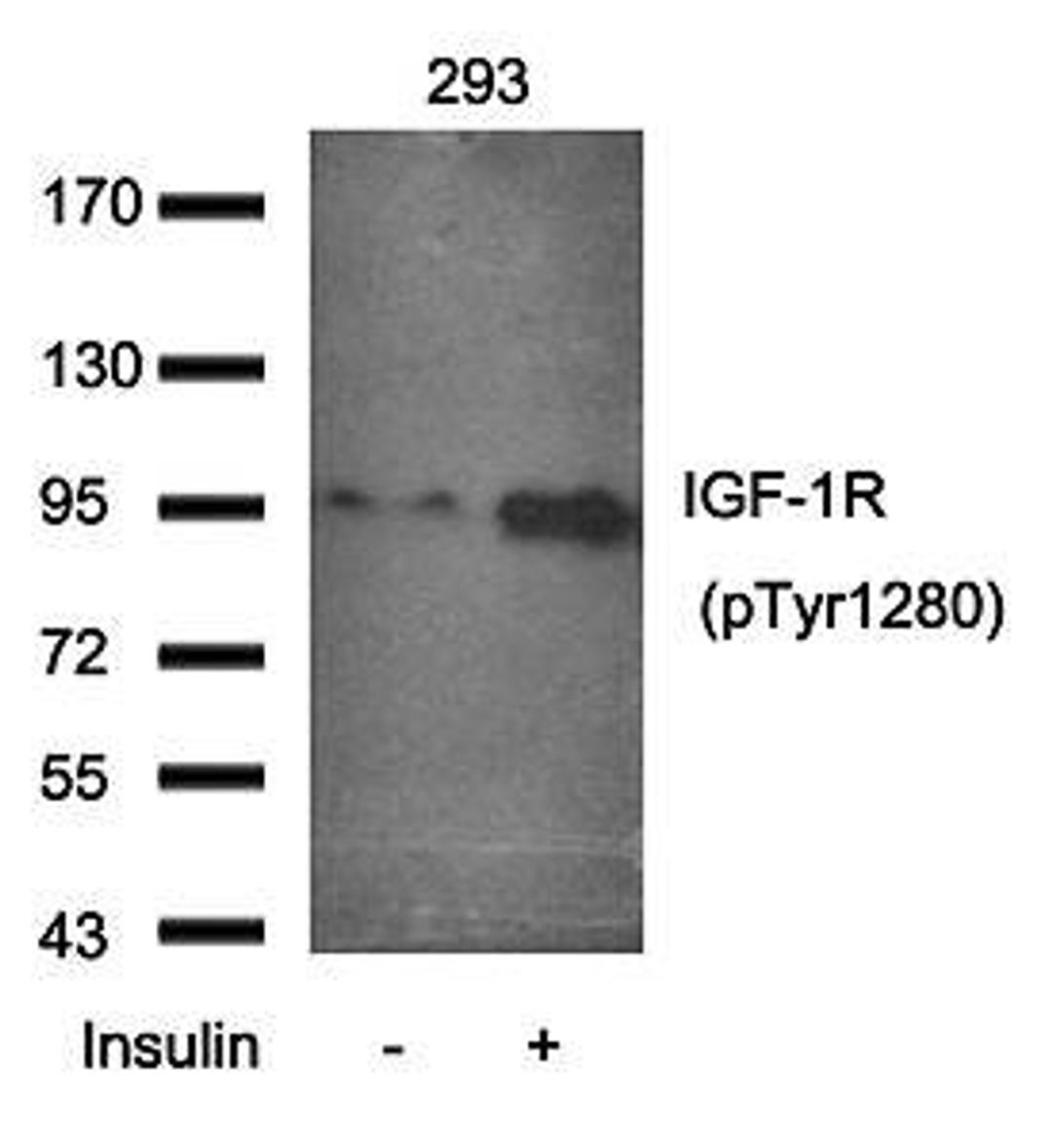 Western blot analysis of IGF-1R(Phospho-Tyr1280) antibody in 293 cells lysates