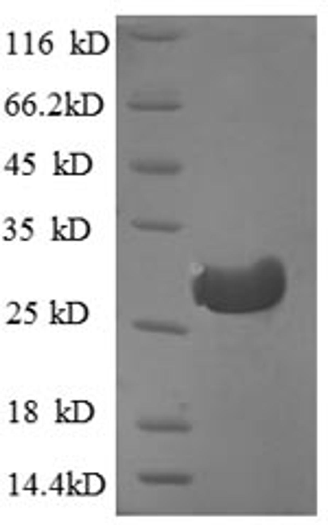 (Tris-Glycine gel) Discontinuous SDS-PAGE (reduced) with 5% enrichment gel and 15% separation gel.