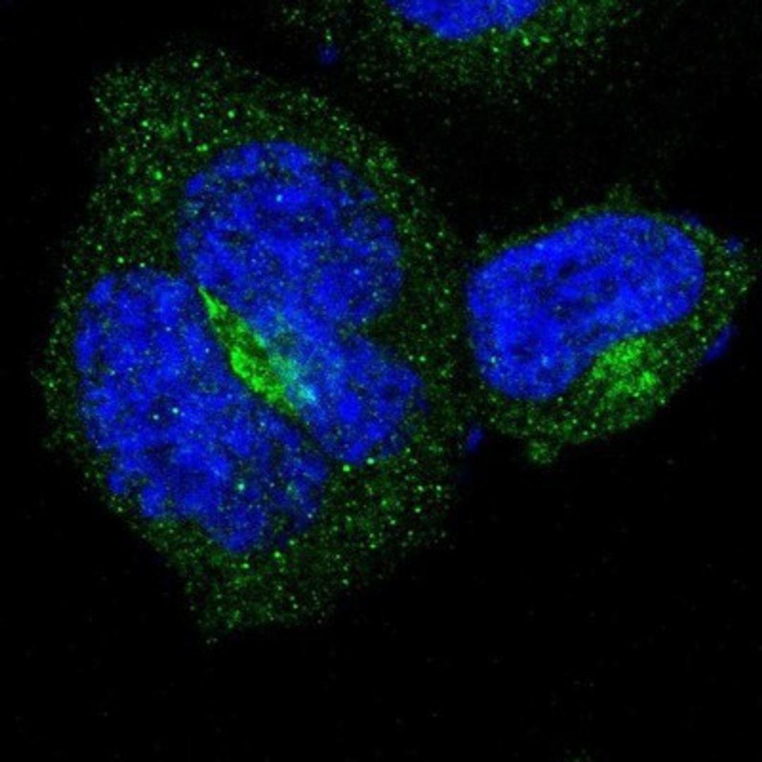 Immunocytochemistry/Immunofluorescence: B4GALT3 Antibody [NBP1-88653] - Staining of human cell line A-431 shows positivity in cytoplasm & golgi apparatus.