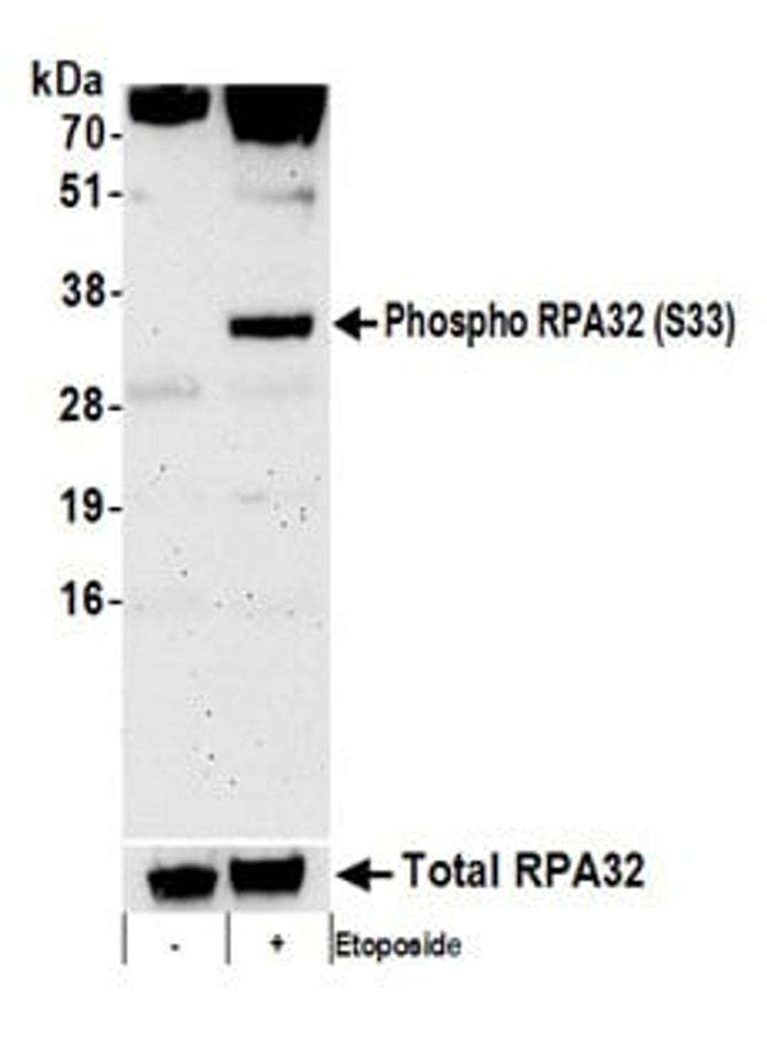 Detection of human Phospho RPA32 (S33) by western blot. Samples: Whole cell lysate (50 µg) from HeLa cells treated with 100 µM etoposide for 16 hours (+) or mock treated (-) cells.