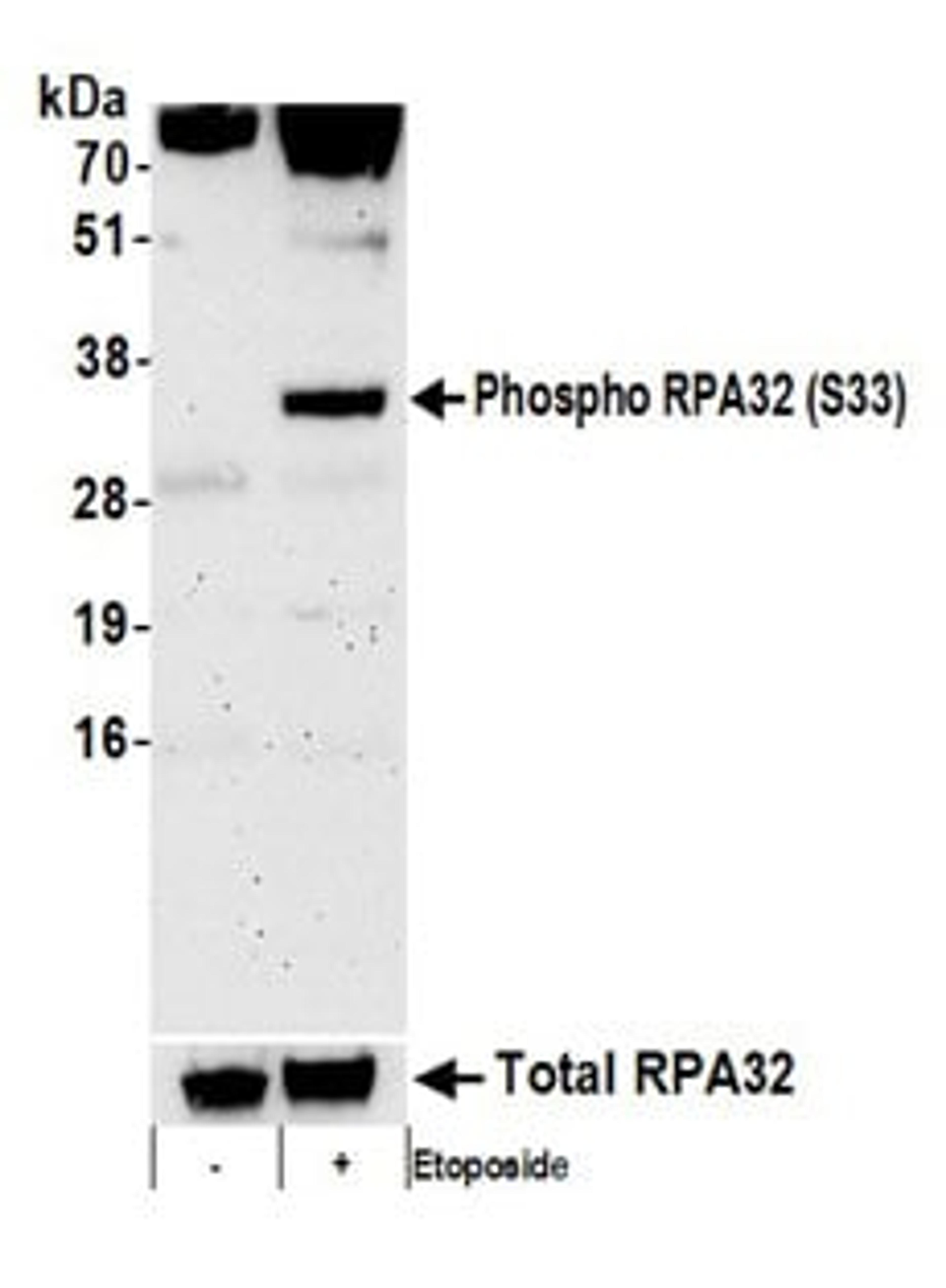 Detection of human Phospho RPA32 (S33) by western blot. Samples: Whole cell lysate (50 µg) from HeLa cells treated with 100 µM etoposide for 16 hours (+) or mock treated (-) cells.