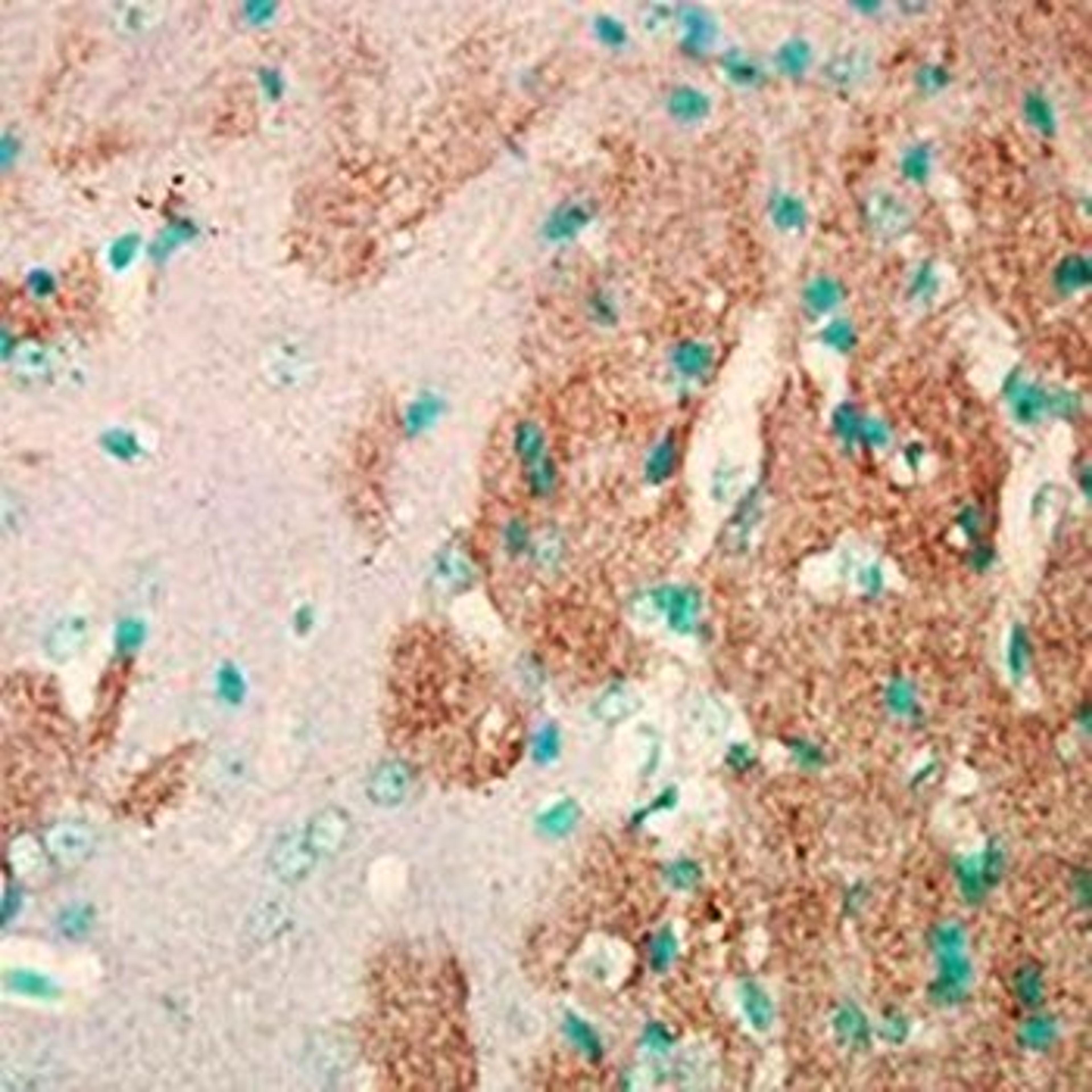 Immunohistochemical analysis of formalin-fixed and paraffin embedded mouse brain tissue using Nav1.7 antibody