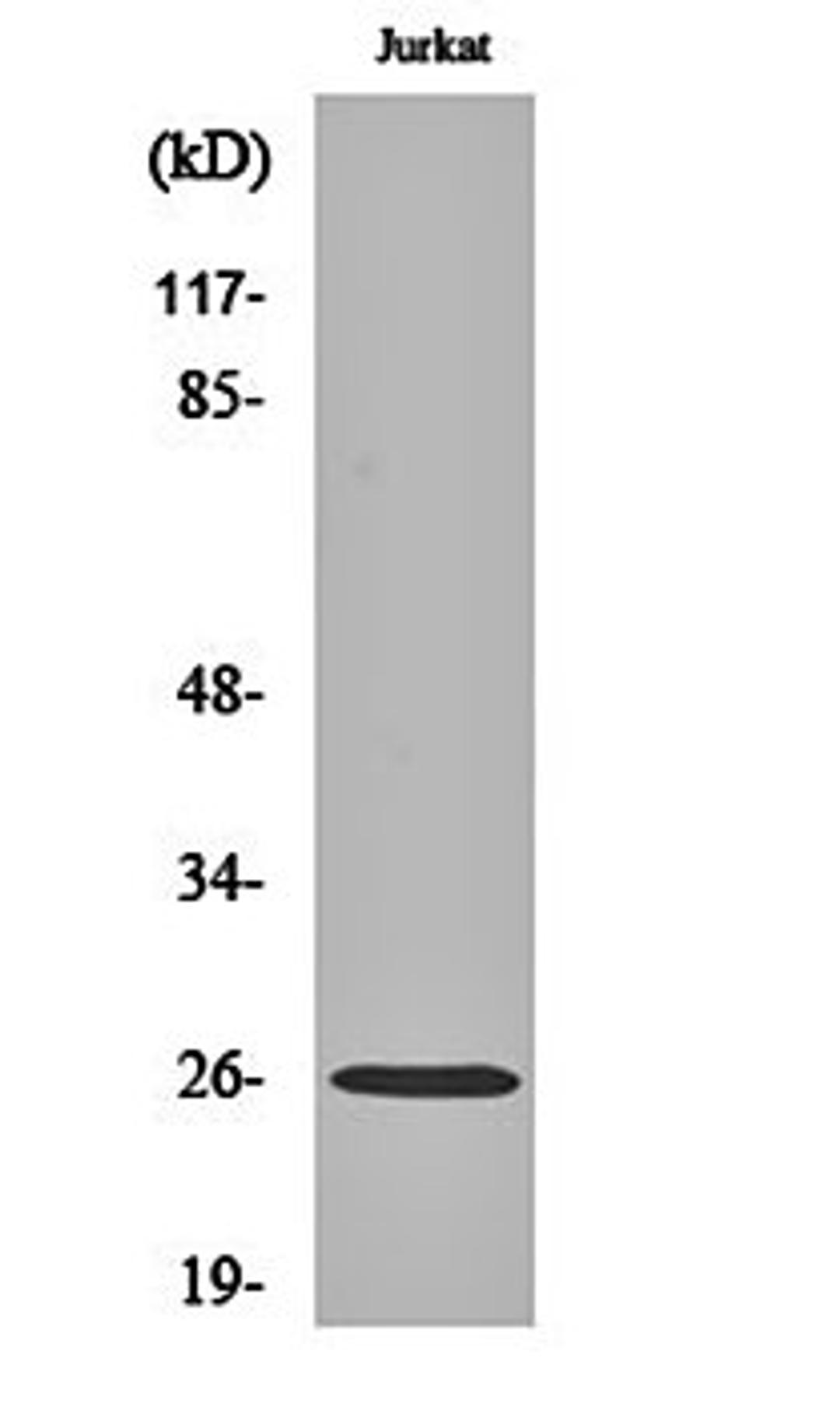 Western blot analysis of Jurkat cell lysates using C1q-B antibody