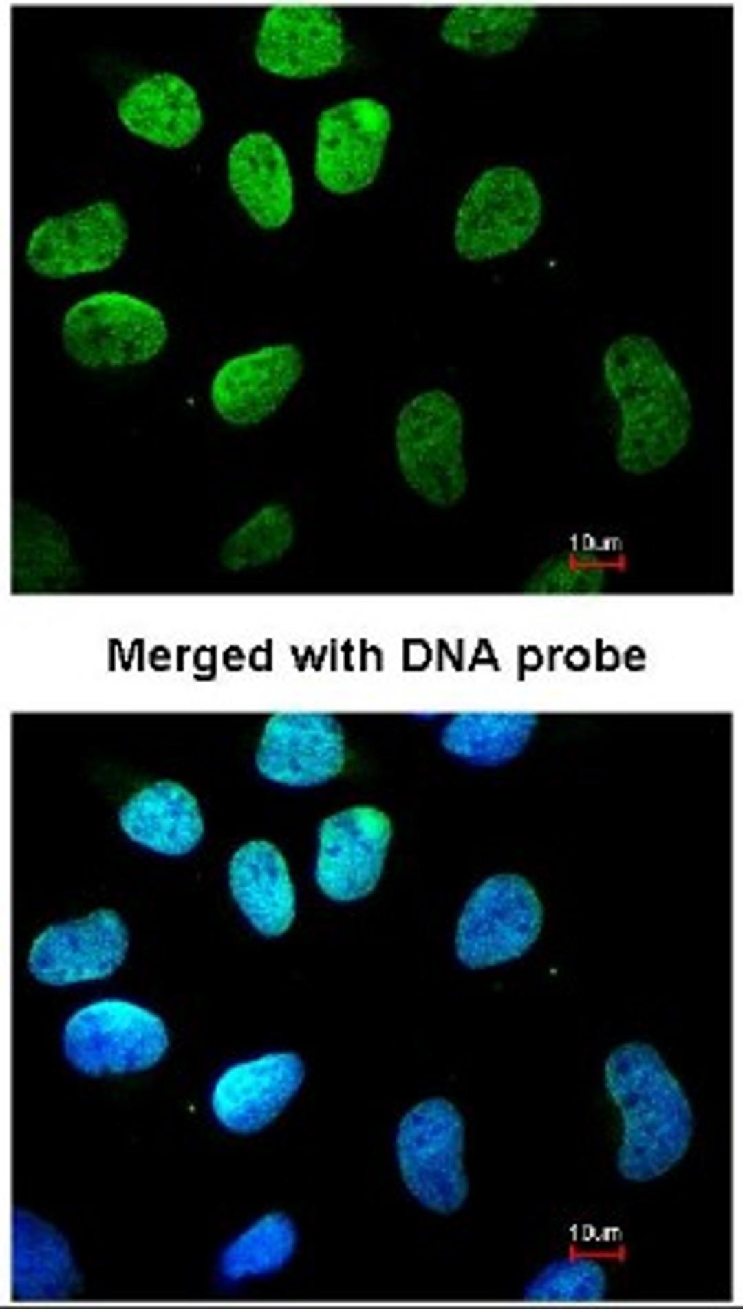 Immunocytochemistry/Immunofluorescence: Vimentin Antibody [NBP1-31327] - Analysis of HeLa, using vimentin antibody at 1:200 dilution.