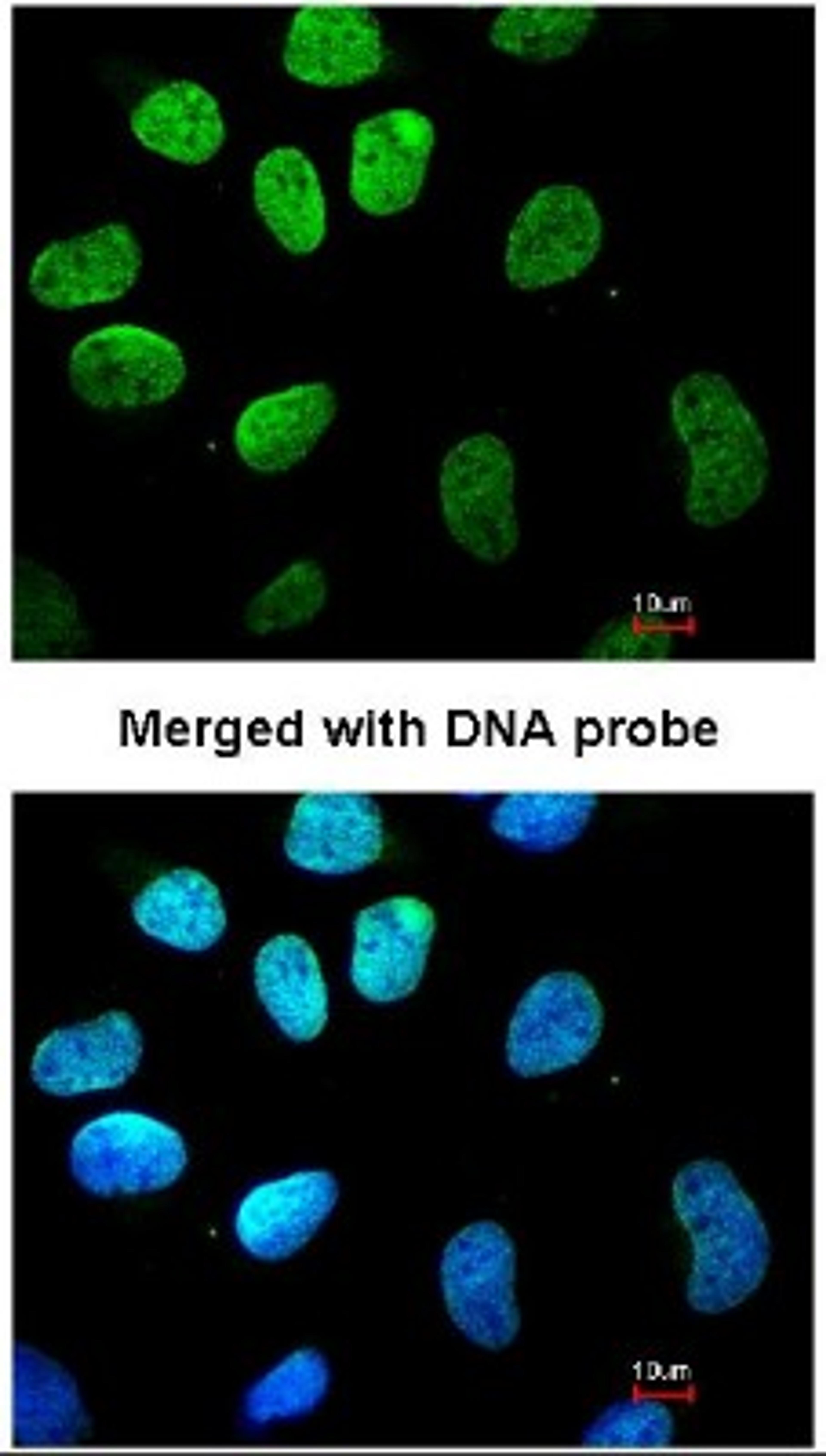 Immunocytochemistry/Immunofluorescence: Vimentin Antibody [NBP1-31327] - Analysis of HeLa, using vimentin antibody at 1:200 dilution.