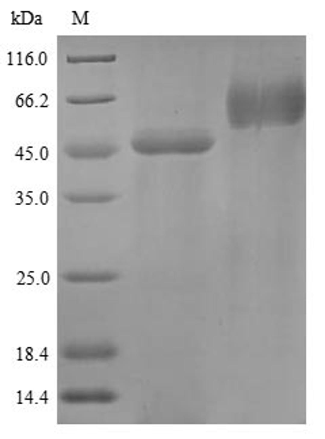 (Tris-Glycine gel) Discontinuous SDS-PAGE (reduced) with 5% enrichment gel and 15% separation gel.