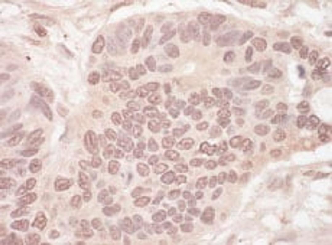 Detection of human SLTM by immunohistochemistry.