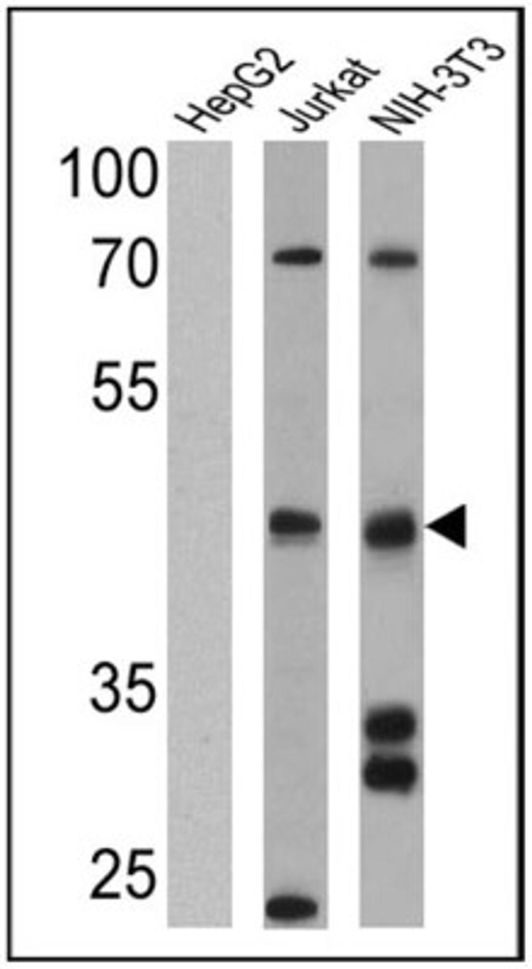 Western Blot: Somatostatin R4/SSTR4 Antibody [NB100-74539] - Analysis of 25 ug of HepG2 (lane 1), Jurkat (lane 2) and NIH-3T3 (lane 3) cell lysates.