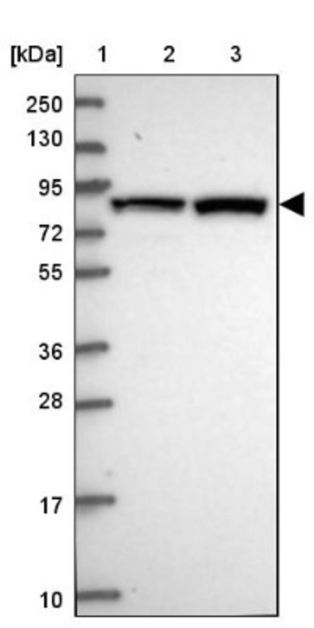 Western Blot: DHX40 Antibody [NBP1-91834] - Lane 1: Marker [kDa] 250, 130, 95, 72, 55, 36, 28, 17, 10<br/>Lane 2: Human cell line RT-4<br/>Lane 3: Human cell line U-251MG sp