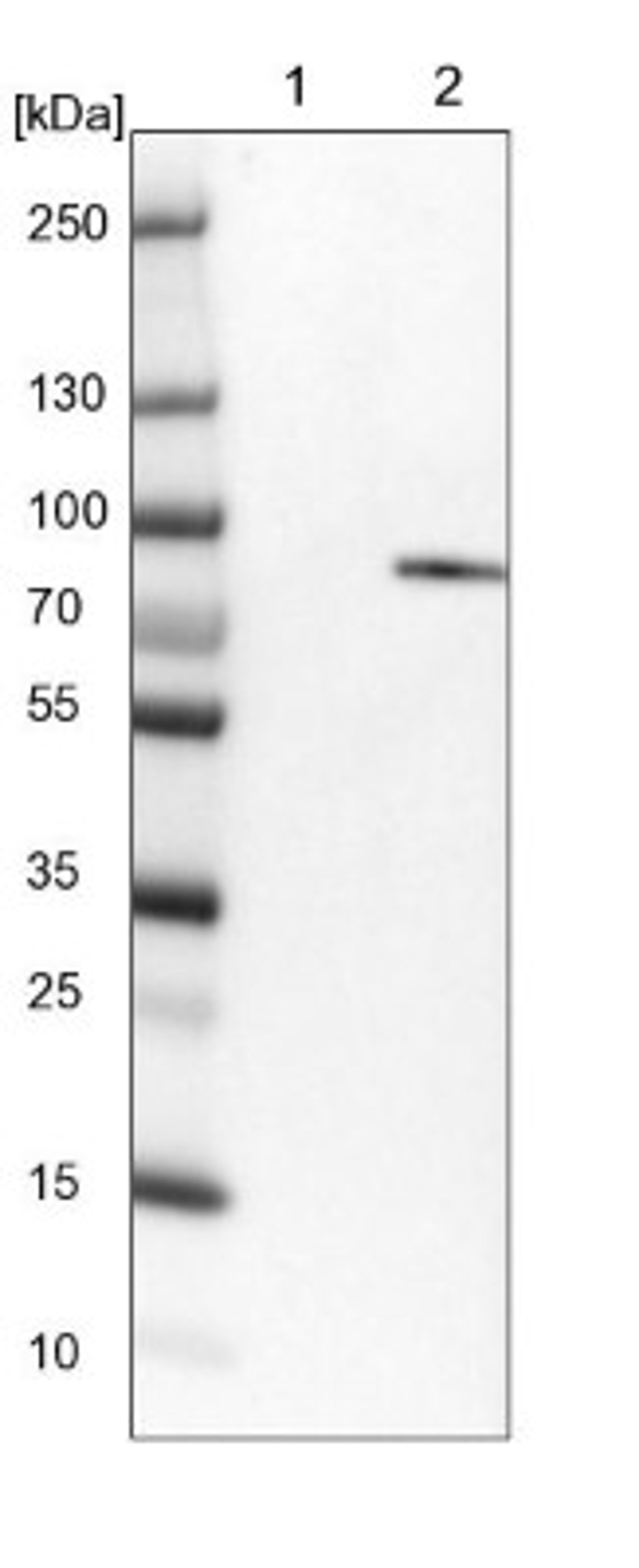 Western Blot: RSK1 Antibody [NBP1-89647] - Lane 1: NIH-3T3 cell lysate (Mouse embryonic fibroblast cells)<br/>Lane 2: NBT-II cell lysate (Rat Wistar bladder tumour cells)