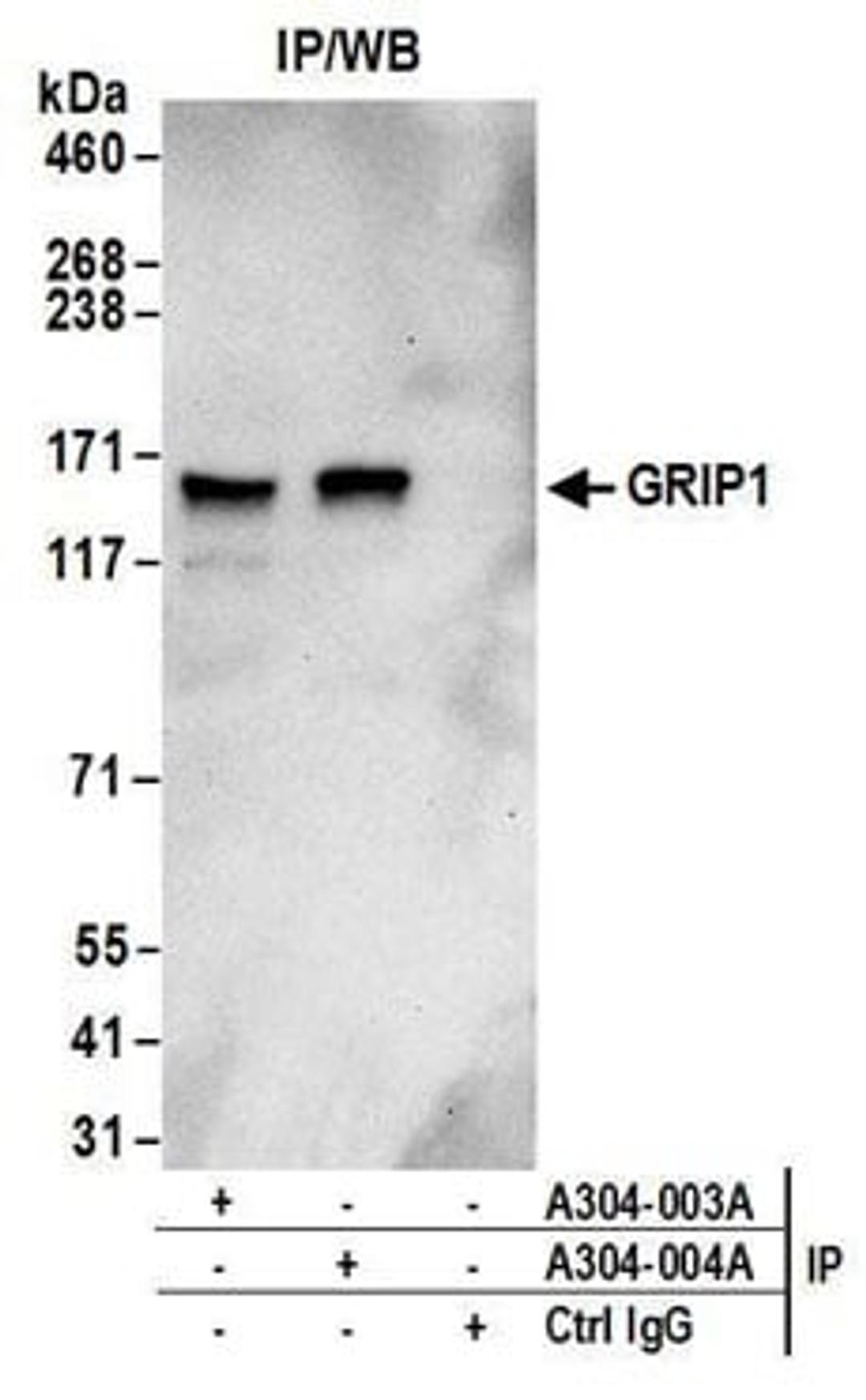 Detection of human GRIP1 by western blot of immunoprecipitates.