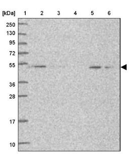 Western Blot: Snx6 Antibody [NBP2-13361] - Lane 1: Marker [kDa] 250, 130, 95, 72, 55, 36, 28, 17, 10<br/>Lane 2: Human cell line RT-4<br/>Lane 3: Human cell line U-251MG sp<br/>Lane 4: Human plasma (IgG/HSA depleted)<br/>Lane 5: Human liver tissue<br/>Lane 6: Human tonsil tissue