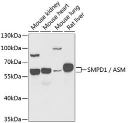 Western blot - SMPD1 / ASM antibody (A6743)