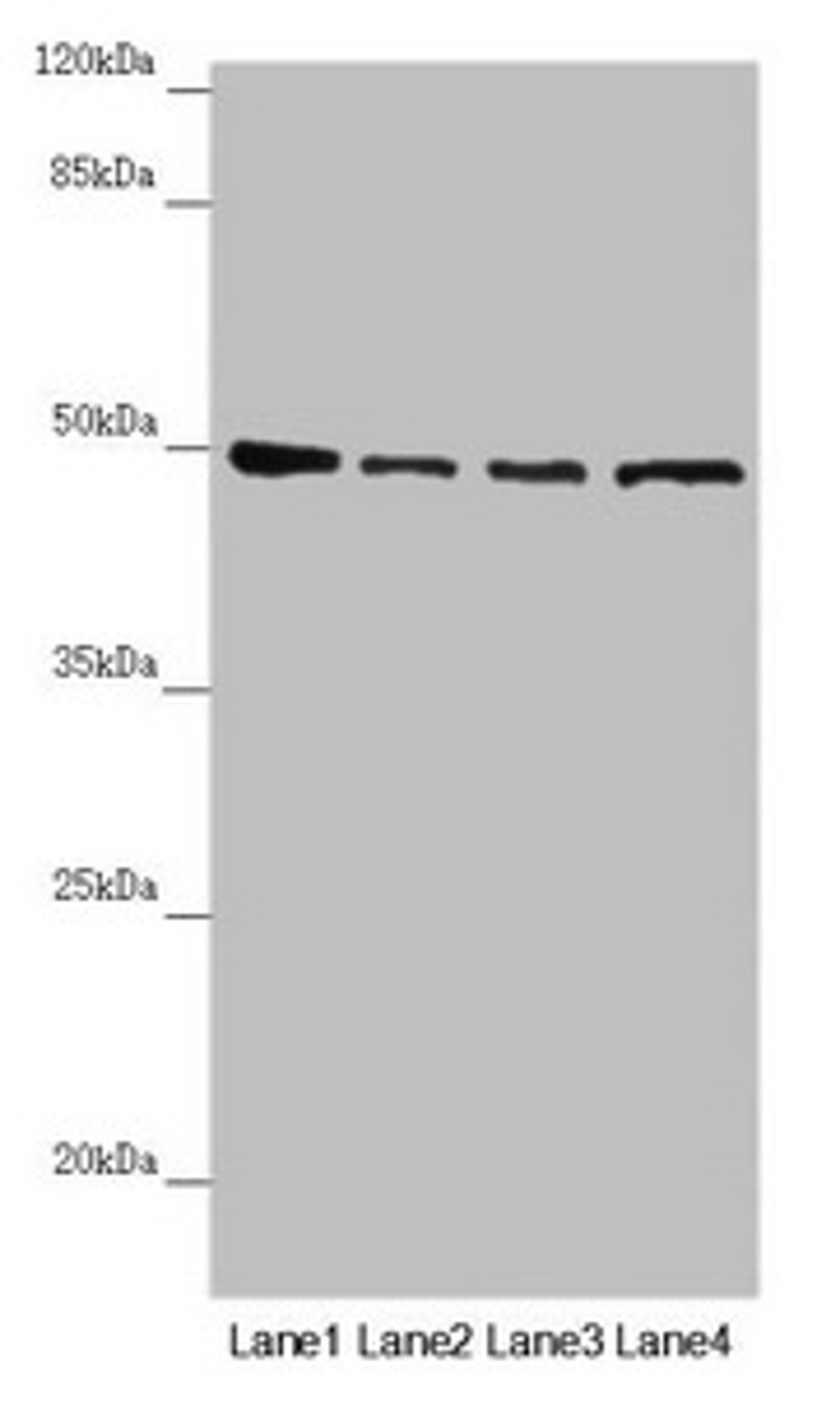 Western blot. All lanes: AP1M1 antibody at 1.43µg/ml. Lane 1: A375 whole cell lysate. Lane 2: Jurkat whole cell lysate. Lane 3: Hela whole cell lysate. Lane 4: HepG2 whole cell lysate. Secondary. Goat polyclonal to rabbit IgG at 1/10000 dilution. Predicted band size: 49, 50 kDa. Observed band size: 49 kDa