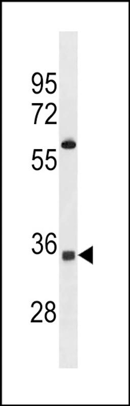 Western blot analysis in Jurkat cell line lysates (35ug/lane).