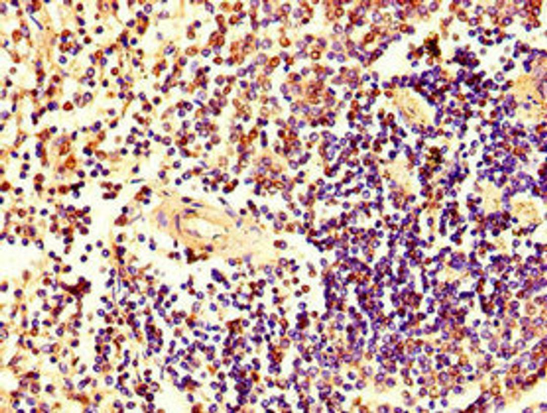Immunohistochemistry of paraffin-embedded human spleen tissue using CSB-PA010726LA01HU at dilution of 1:100