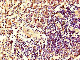 Immunohistochemistry of paraffin-embedded human spleen tissue using CSB-PA010726LA01HU at dilution of 1:100