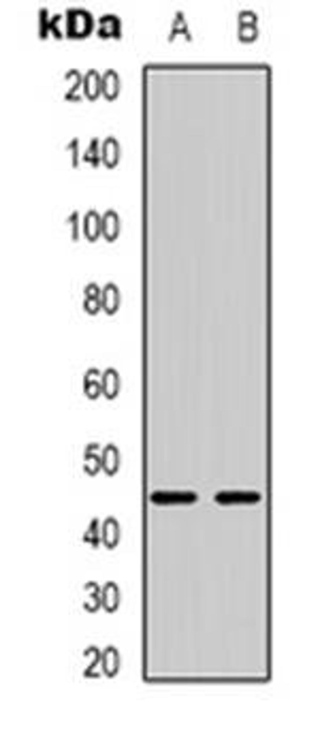 Western blot analysis of BTBD6 expression in HepG2 (Lane 1), MCF7 (Lane 2) whole cell lysates using BTBD6 antibody