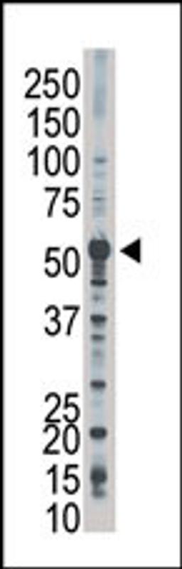 Antibody is used in Western blot to detect PFKFB2 in Jurkat cell lysate.