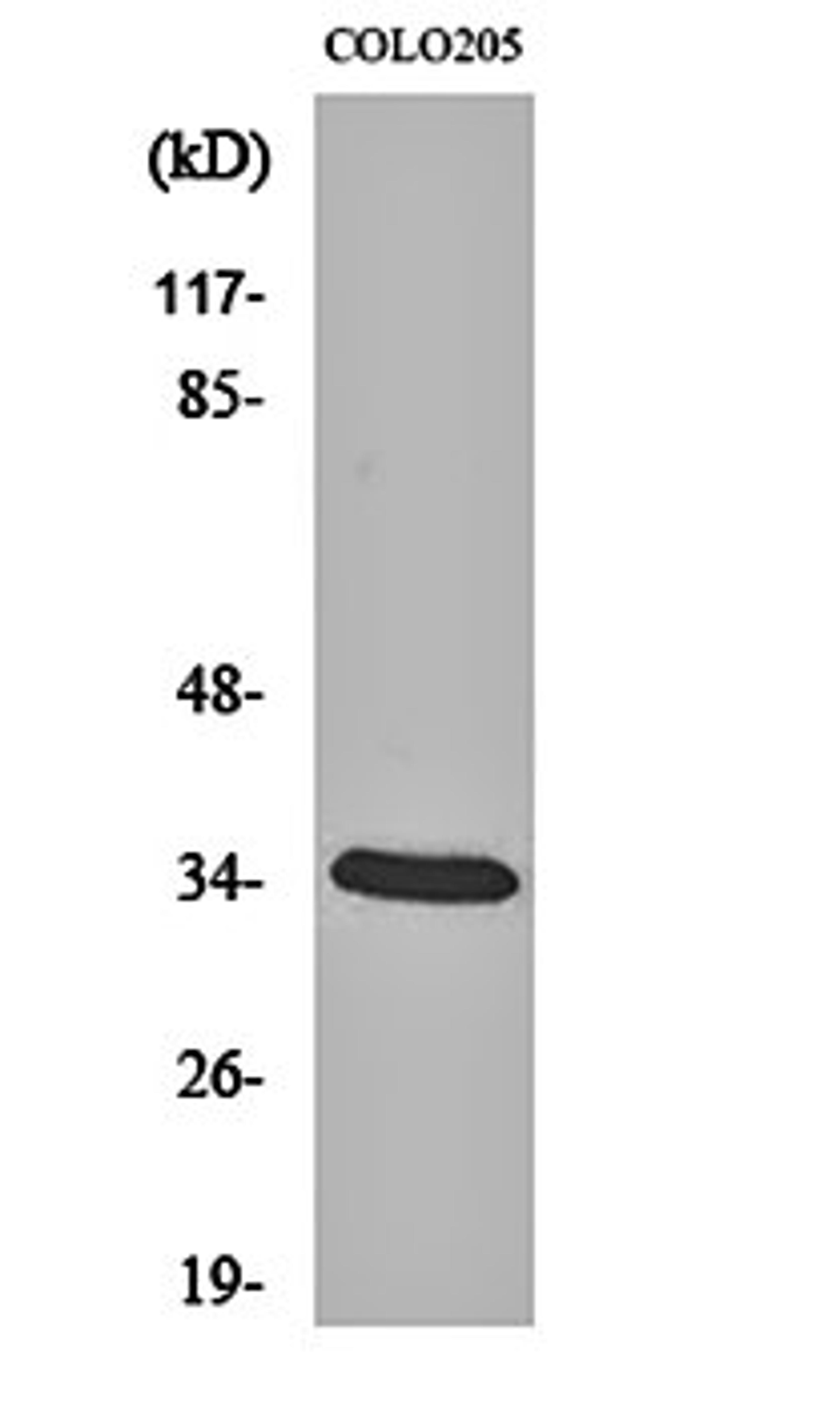 Western blot analysis of COLO205 cell lysates using MOX-2 antibody