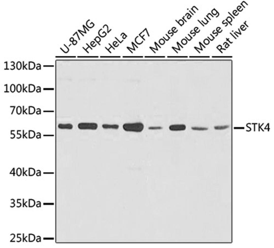 Western blot - STK4 antibody (A8043)