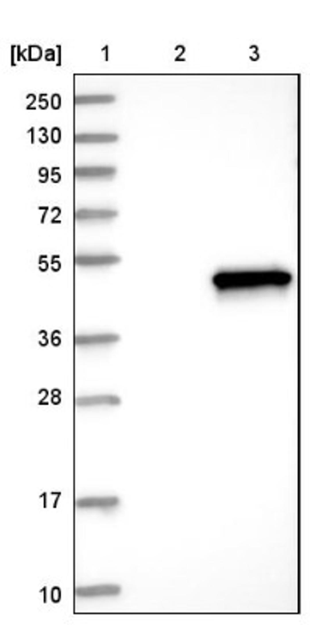 Western Blot: beta Sarcoglycan Antibody [NBP1-90300] - Lane 1: Marker [kDa] 250, 130, 95, 72, 55, 36, 28, 17, 10<br/>Lane 2: Negative control (vector only transfected HEK293T lysate)<br/>Lane 3: Over-expression lysate (Co-expressed with a C-terminal myc-DDK tag (~3.1 kDa) in mammalian HEK293T cells, LY400093)