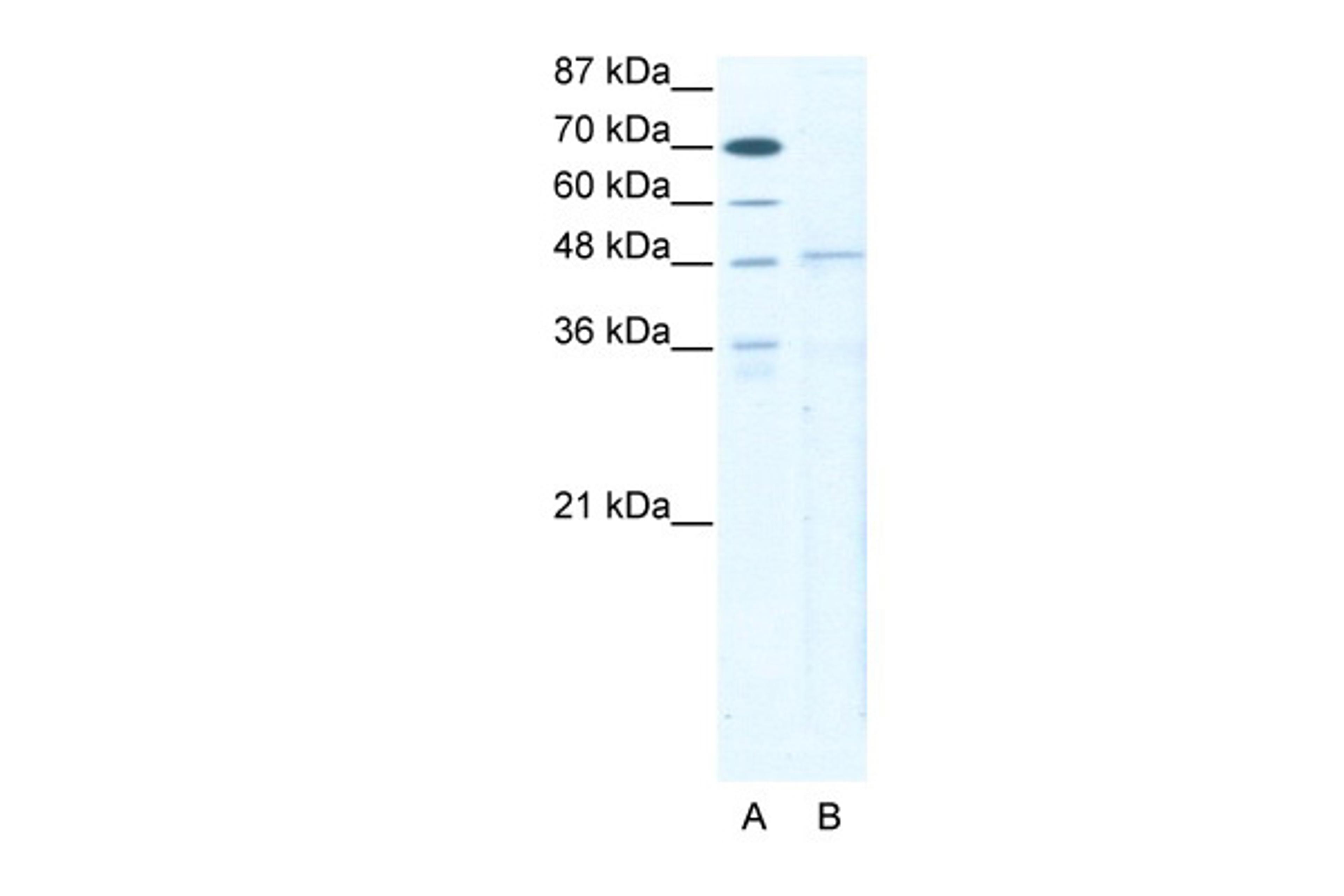 Antibody used in WB on Human HepG2 at 5 ug/ml.