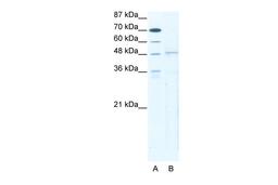 Antibody used in WB on Human HepG2 at 5 ug/ml.